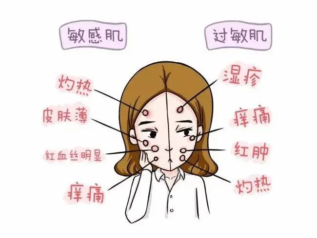 换季敏感肌自查 平时在家别乱搞