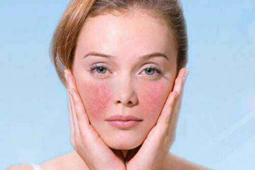 过敏怎么办（简单、快速处理皮肤过敏的方法）