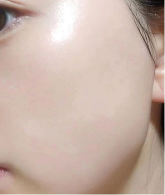 敏感肌肤怎么修复最快