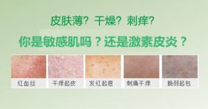 敏感肌肤
