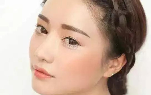 敏感肌肤经常长痘痘，是炸鸡、汉堡的错吗？